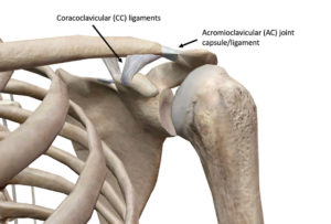 AC joint injury