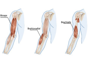 Distal Biceps Tendinopathy, A Pain In the Elbow