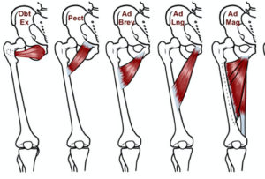 Adductor Strain As A Cause Of Groin Pain