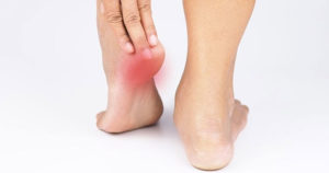 Misconceptions about Heel Pain