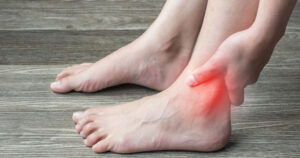 Chronic ankle pain - when acute ankle sprains don't resolve
